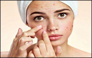 Các loại mụn trên mặt