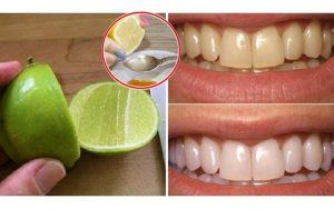 cách làm trắng răng bằng chanh