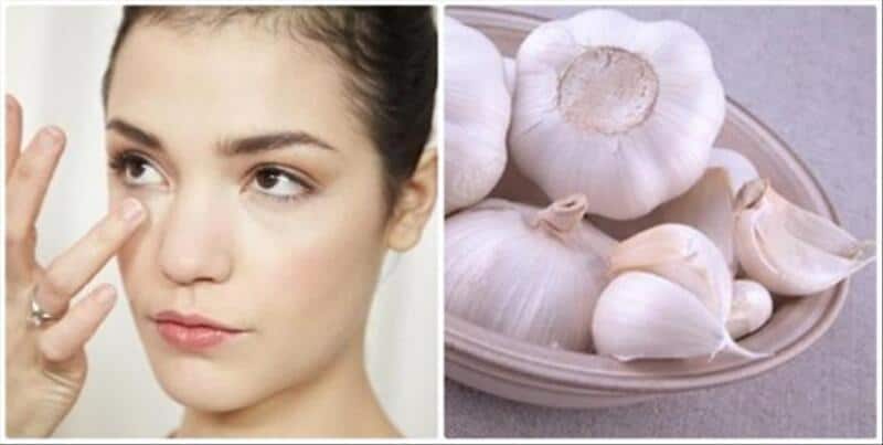 Cách trị mụn trứng cá