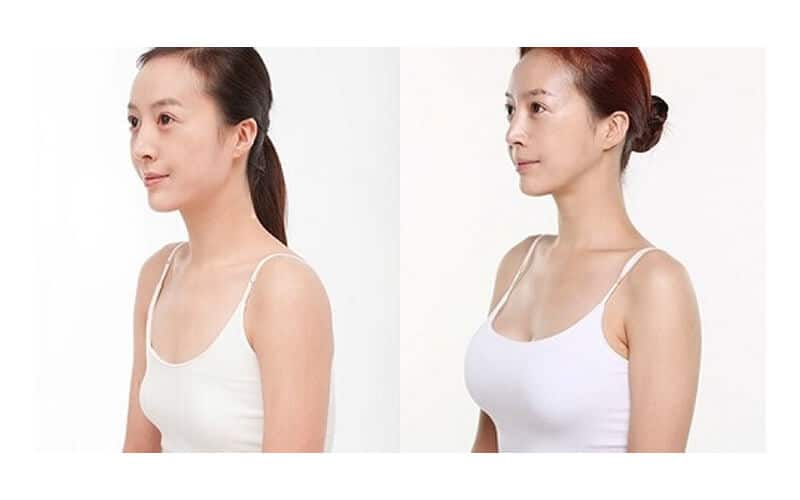 Công dụng viên uống tăng vòng 1 DHC