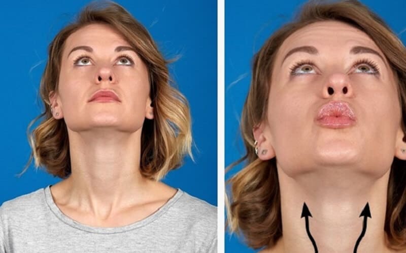 Bài tập cằm v line căng cổ