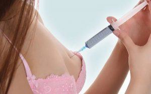 Tăng vòng 1 với phương pháp tiêm Filler